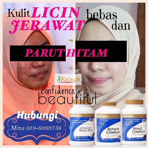 Inilah kosmetik halal best selling, wajib coba! 7 Produk Hilangkan Parut Jerawat Hitam Dan Berlubang ...