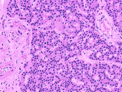 However, the precise mechanisms by which notch signaling patterns the distal nephron and collecting duct cell fates is unknown. Parathryroid