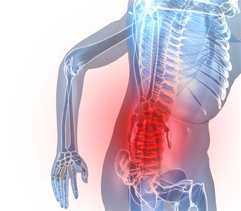 I.e., they do not carry as much risk of excessive and potentially dangerous motion of the injured parts of the spine. Oklahoma Spinal Cord Injury Lawyers Fighting for the Injured