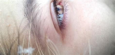 Here we'll guide you to the very best prices available today. Die okuläre Rosacea (Augen-Rosacea) - LZ Gesundheitsreport