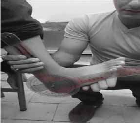 Open Access Journal of Sports Medicine