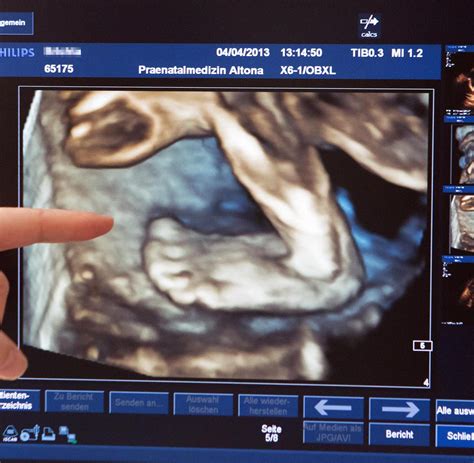 Wann lässt sich der früheste schwangerschaftstest durchführen? 51 Top Pictures Wann Kann Man Feststellen Dass Man ...
