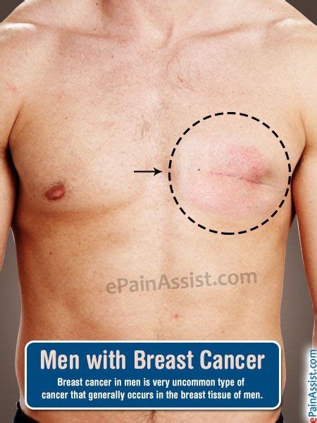 Cancer man personality positive traits. Chest Cancer Symptoms In Men - Cancer News Update