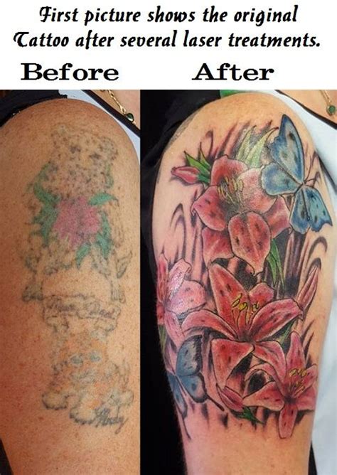 Tattoo removal is often done as an outpatient procedure with local anesthesia. Pin by Buzz Tattoo on Laser Tattoo removal | Cover tattoo ...