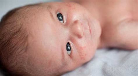Minum air putih secara cukup juga akan menjaga tubuh terhidrasi dengan baik 7. Waspadai bintik merah pada bayi | Bayi, Kulit, Merah