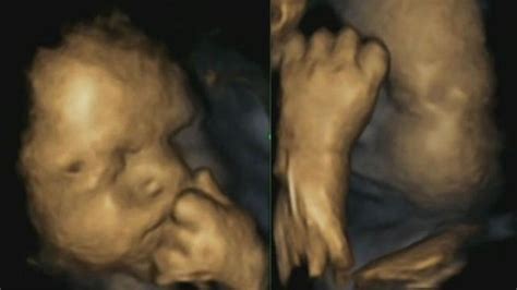 Ukuran gambar pada janin bisa menjadi indikator usia kehamilan dan informasi. Gambar Usg Bayi 7 Bulan Dalam Kandungan - Info Terkait Gambar