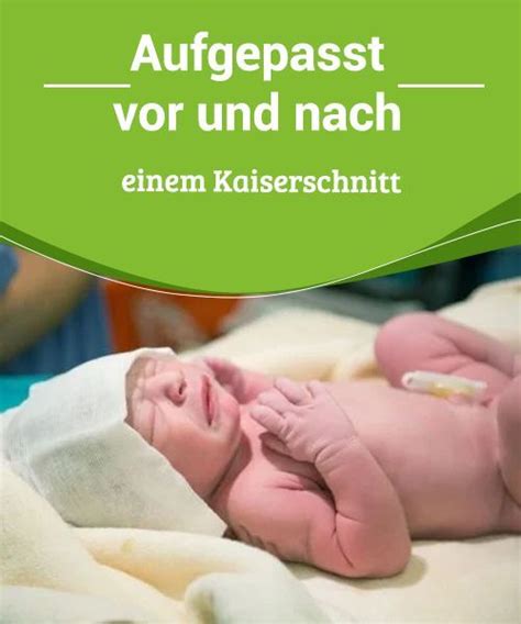 Letztlich ist es euer körper und euer baby und nur ihr könnt entscheiden, was sich für euch richtig anfühlt! Aufgepasst vor und nach einem Kaiserschnitt - Besser ...