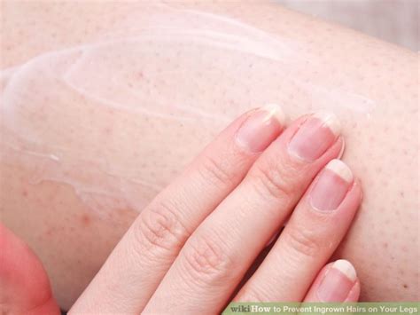 Soak ingrown leg hairs and prevent scars. How to Prevent Ingrown Hairs on Your Legs: 15 Steps