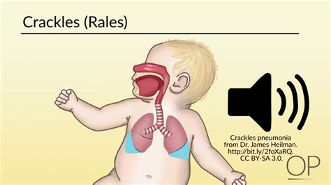 Paralysis would also affect the respiratory system leading to elevated breathing rates and an increase in carbon dioxide expiration. "Respiratory Assessment" by Brienne Leary for ...