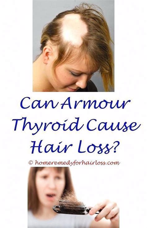 Can the mirena coil cause hair loss. Why does glucosamine cause hair loss - Health