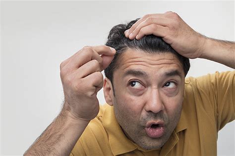 I think its pretty safe to say once the process starts its more often then not going to continue at some pace forever. How To Stop Hair Thinning? - Smarter Support