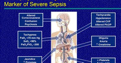 Bukti klinisnya berupa suhu tubuh yang. The Pharmacist Room: TERAPI ANTIBIOTIK PADA SEPSIS FEBRILE ...