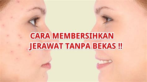 Maybe you would like to learn more about one of these? Cara Membuat Masker Beras Bengkoang | 081809471757 - YouTube