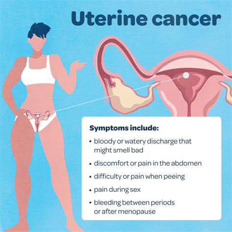 Cancer that comes back after treatment is called a recurrence. What is gynaecological cancer and what are the symptoms ...