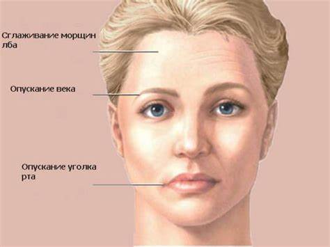 Диета при невралгии тройничного нерва Лечение невралгии тройничного нерва в Москве в медицинском центре Лечение невралгии тройничного нерва в Москве в медицинском центре Диета при невралгии тройничного нерва