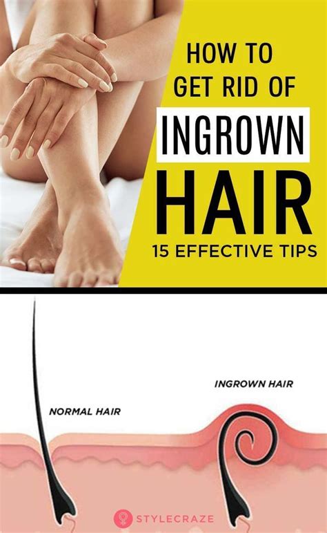 If you have stubborn facial hair, then barley is a very good scrub that you can use on your face to get rid of unwanted hair. 15 Simple Tips To Reduce The Growth Of Ingrown Hair # ...