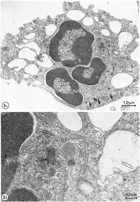 For that, the students must follow plant cells have large vacuoles, while animal cells have multiple and small vacuoles. a Another cell treated as in Fig. 4. The vacuoles are ...