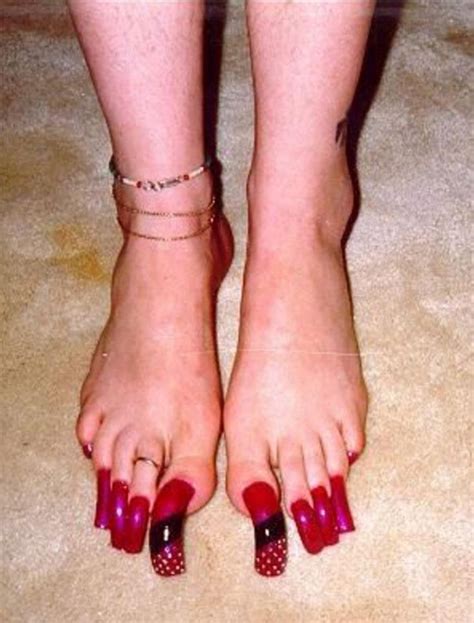 Bezpłatna usługa google szybko przetłumaczy słowa, zwroty i strony internetowe z polskiego na ponad 100 innych języków i odwrotnie. 12 fotos de las peores uñas de los pies en el mundo. La ...