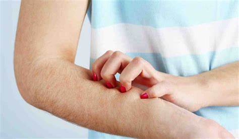 Токсикодермия лечение и диета Токсикодермия: лечение, причины и симптомы Токсикодермия: лечение, причины и симптомы Токсикодермия лечение и диета