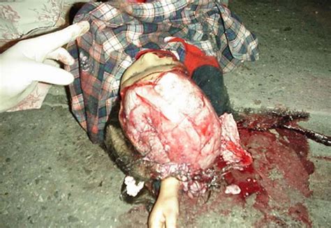 Take a look and explore other websites that resemble documentingreality. Young Girl Killed By Bus