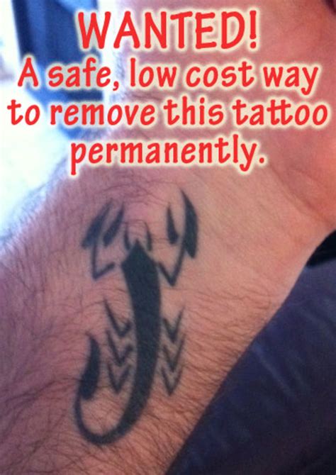 Laser, tattoo removal, get rid of tattoo instantly at home, best tattoo removal, remove tattoo, tattoo removal cream, natural ink removal, cheap tattoo removal, how to remove 10 effective ways to remove skin tags naturally. My Search for a Real Way to Remove My Tattoo Without ...