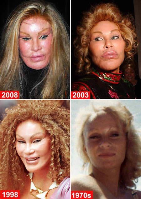 That has to be a psychological condition. Christy Turlington Nose Job: Pictures Revealing True Story