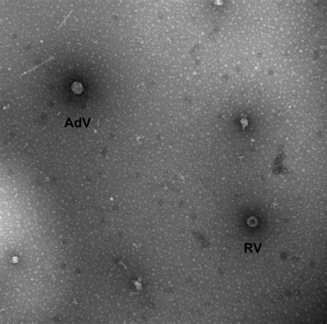 The most common symptom of rotavirus is severe diarrhea. Figure 1 - Detection of Novel Rotavirus Strain by Vaccine ...