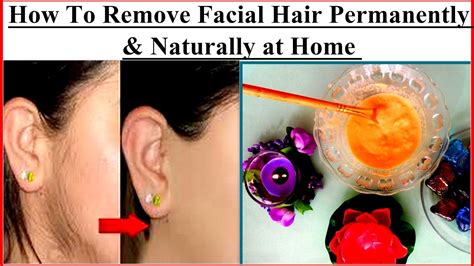 If you have excessive facial hair growth, you must consult your doctor. How To Remove Facial Hair Permanently & Naturally at Home ...