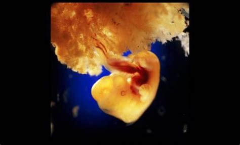 Mewarnai gambar bayi yesus halaman mewarnai natal. 25 Gambar Pembentukan Bayi Dalam Kandungan Setelah 12 Tahun Dirakam. Menakjubkan!