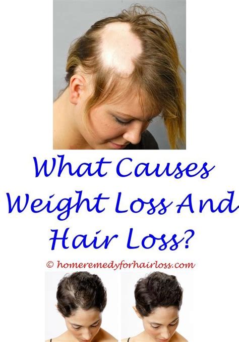 Corticosteroids (also known as steroids) are medicines used for reducing inflammation. Clobetasol For Hair Growth - The 10 Biggest 2020 Haircut ...