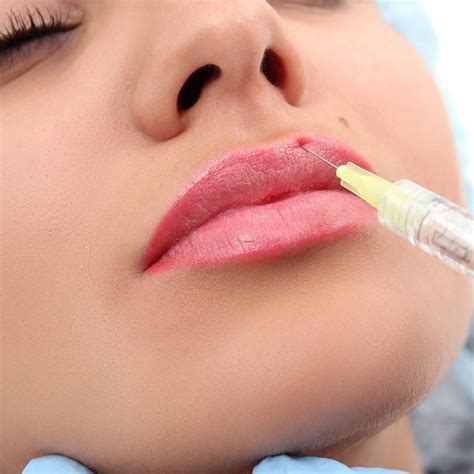 Clinic specialists efficiently and effectively carry out treatment, rehabilitation of patients thanks to their vast experience not only in ukraine but also in the usa and europe. Lip Filler Augmentation in Indore in Indore, India