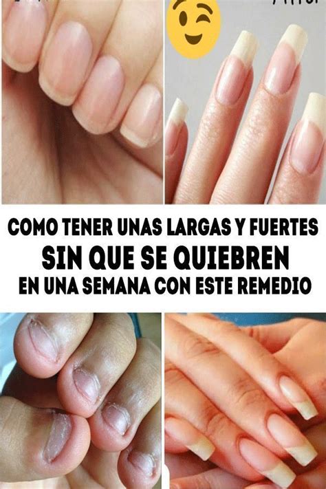 Maybe you would like to learn more about one of these? Pin en Crecer las uñas