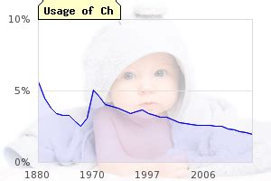 Choosing a name for your new baby is no easy feat. "CH" Boy Names Beginning with Ch-