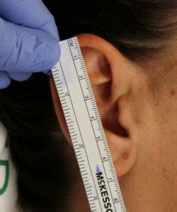 Make your forehead smaller without makeup or surgery. Make My Ears Smaller in Size | World Expert in Making Ears ...