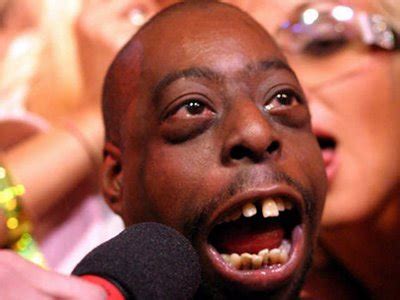 Beetlejuice from the howard stern show might have a death wish. Lester Green (@beatlepimp) | Twitter