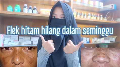 Patch tool adalah tool photoshop yang berfungsi untuk menghilangkan objek tertentu pada sebuah gambar. Menghilangkan Flek Hitam di Wajah - YouTube