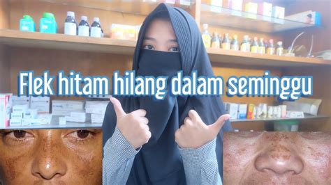 Tidak lupa, rekomendasi merk terbaiknya, seperti olay, l'oreal paris, kojie san, dan shiseido. Menghilangkan Flek Hitam di Wajah - YouTube