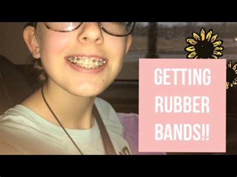 What happens when your braces get tightened? Getting our Braces Tightened! (Getting Rubber Bands) - YouTube