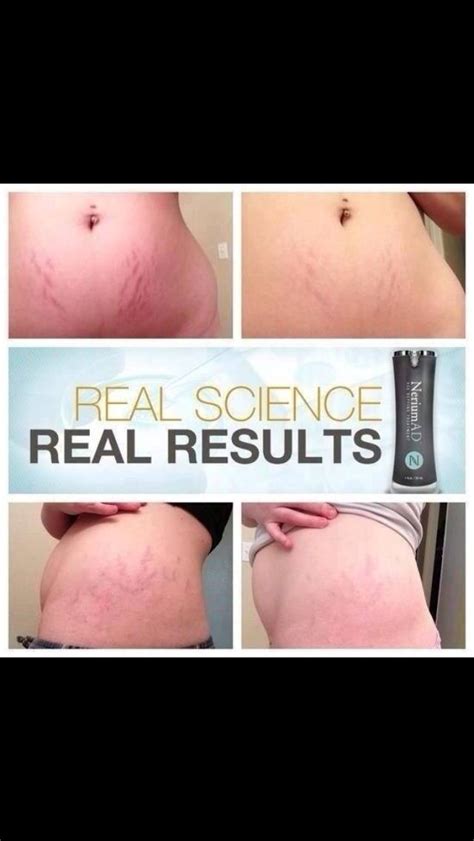 Between dead skin cells and sun exposure at your consultation, we can work with you to determine the best skinceuticals products to help you fix. Nerium is rising as the fastest growing company! If you ...