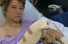 teen fingers loses bomb nz stuff australia