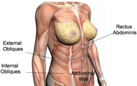 Female abdominal anatomy, computer illustration. Gallery For > Female Abdominal Muscle Anatomy | MUSCLES ...