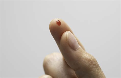 Viele patienten messen jedoch entweder zu oft oder zu selten ihren blutzucker. Blutzucker | Tipps zur Selbstkontrolle ...