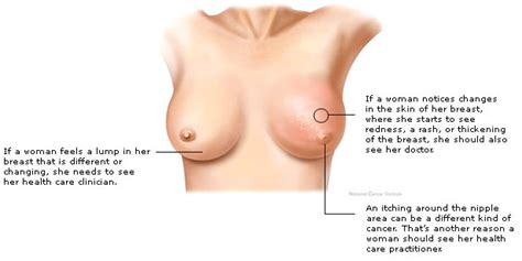 Most don't notice any signs at all. The Lower Your Bone Density, The Lower Your Breast Cancer ...