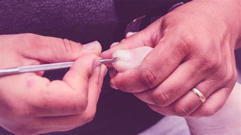 Yogurt is a magical ingredient that helps in solving most of your skin issues. Manicurist Using Pliers To Remove Dead Skin From Around ...