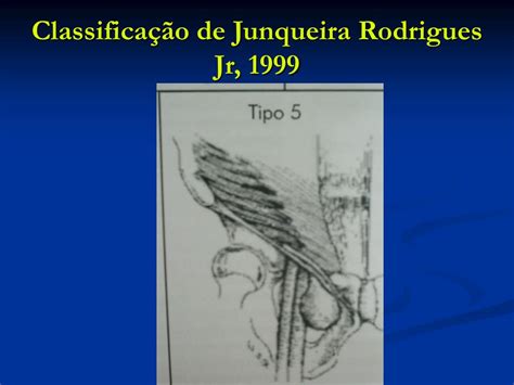 In di fer otra (xd). PPT - Anatomia da Região Inguinal e Crural PowerPoint ...