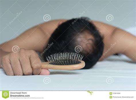 Toppik hair building fibers make fine, thin hair look thick and full instantly. Asian Man So Worried About Hair Loss. Stock Photo - Image ...