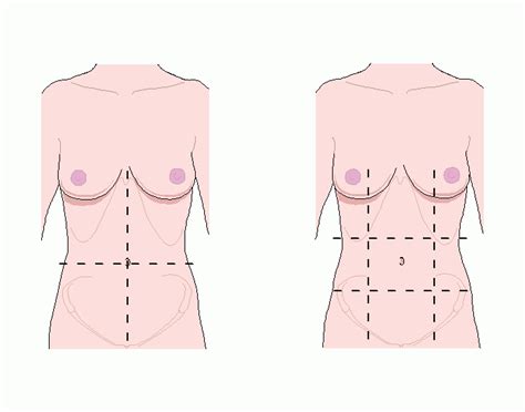 Quadrants are a mapping device. Game Statistics - Four quadrants and nine regions of the abdomen