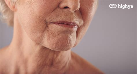 17 jan 2019 5:00 am | posted by. Crepey Skin: Causes, Prevention and Treatment