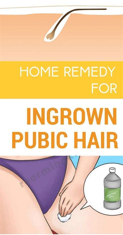 Although it provides a quick fix, tweezing hair can break off the prevention 101: Home Remedy For Ingrown Hair #hairlosshomeremedies # ...