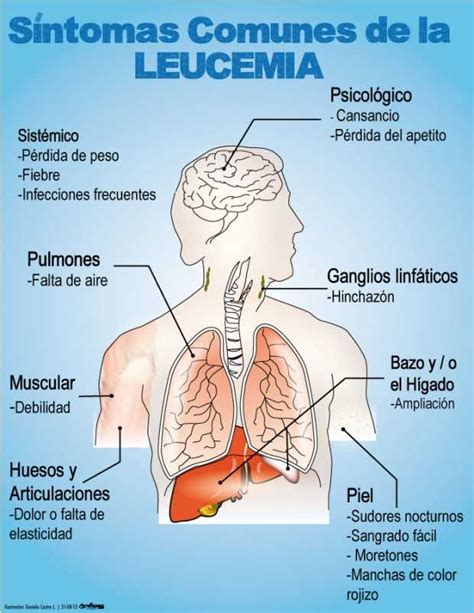 Las enfermedades que el gato puede transmitir a los humanos son la toxoplasmosis y la rabia: Domingo, Septiembre 1, 2013